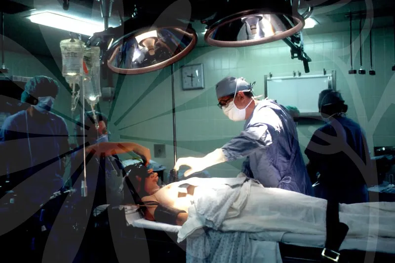 DORSAL_HUMP_RHINOPLASTY