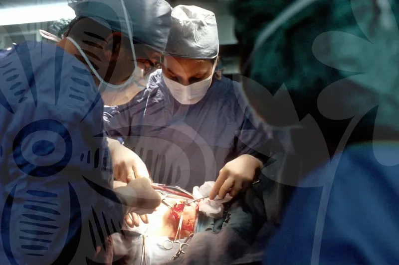 NOSE_SURGERY_REVIEWS