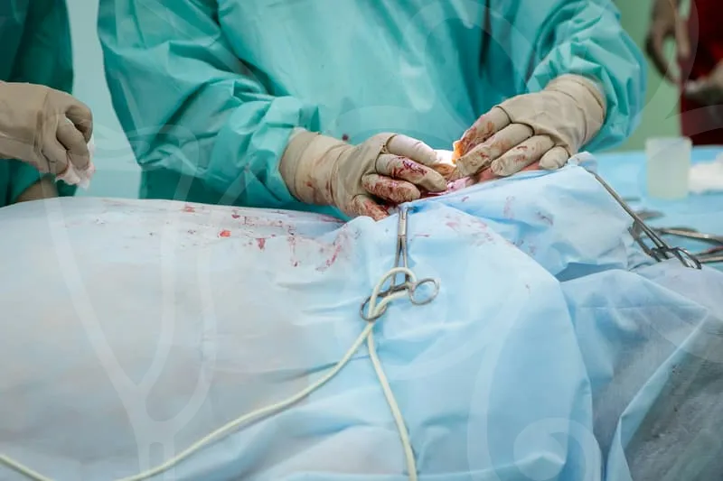 NOSE_SURGERY_REVIEWS