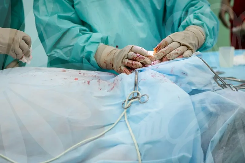 REVISION_RHINOPLASTY