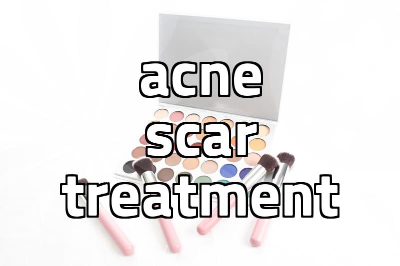 Professional skin clinic acne extraction facts and procedures