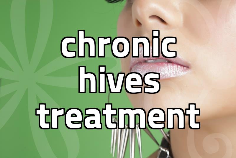 두드러기피부과 visits and what treatments actually cost