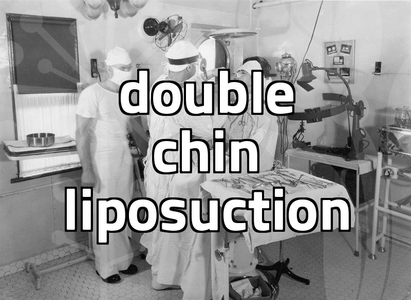 I finally decided to do something about the double chin that wouldn’t go away