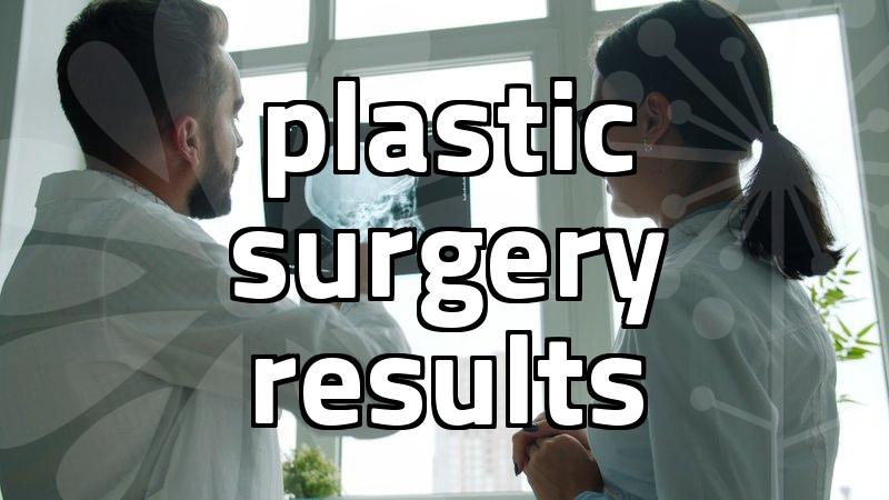 수술후기 analysis and finding authentic patient results