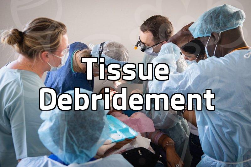 Why Nasal Foreign Body Removal Requires A Surgical Strategy Instead Of Simple Extraction